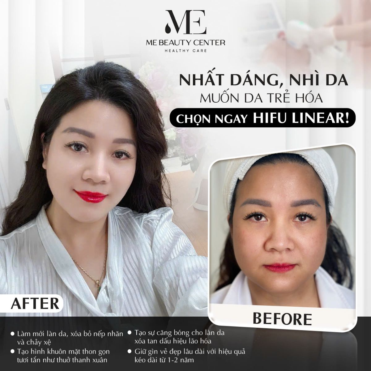 Hình ảnh TM Branding thực hiện cho đối tác cơ sở làm đẹp ME Beauty Center